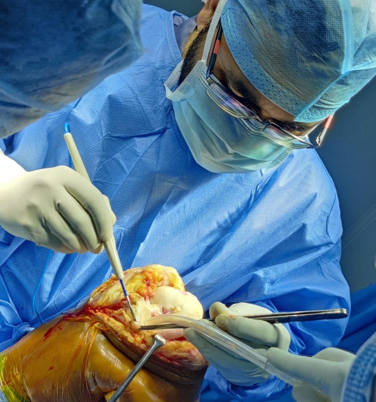 Dr. S. Sameer Chaitanya performing orthopaedic surgery