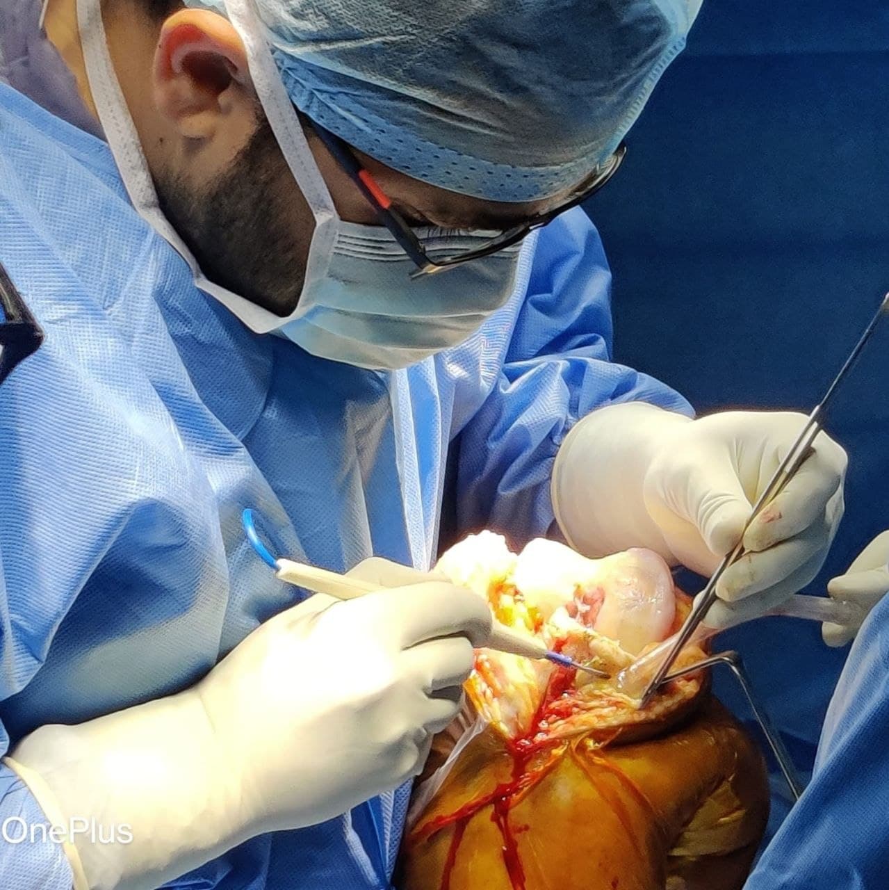 Dr. S. Sameer Chaitanya performing joint surgery
